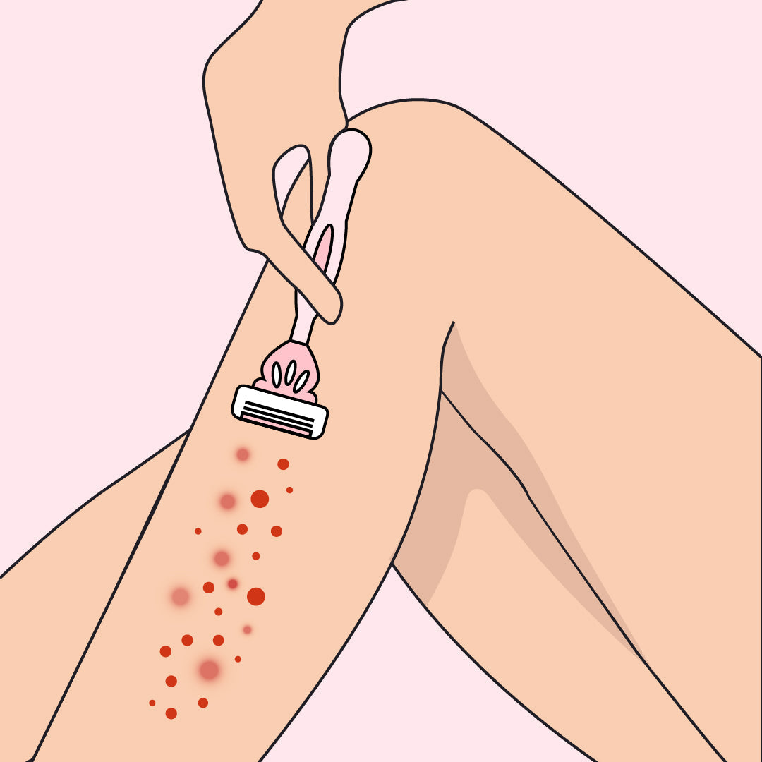 How to prevent razor bumps after shaving